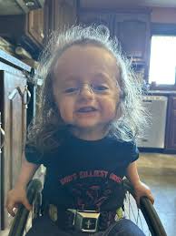 Pre-op hunger pangs before noon surgery