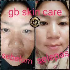 Premium products hand picked by your favorite celebrities. Glowing Beauty Skincare Produk Viral Dimana Dpt Membantu Masalah Skin Yang Anda Hadapi Iklanviral Net