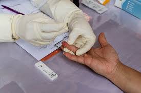 Kemenkes Bukan Harga Eceran Alat Rp 150 000 Tarif Pemeriksaan Rapid Test Halaman All Kompas Com