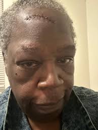 song lyrics about past accident and injury