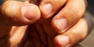 Check spelling or type a new query. 7 Nail Symptoms And Conditions You Shouldn T Ignore Today