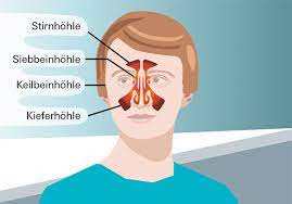Studien bestätigen, dass diese rezept­pflichtigen mittel die beschwerden lindern können. Nasennebenhohlenentzundung So Bekommen Sie Den Kopf Wieder Frei Stiftung Warentest