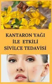 Kantaron Yagi Ile Sivilce Tedavisi Sivilce Izi Cilt Bakimi Akne Tedavisi