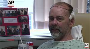 Médicos americanos realizam histórico transplante de crânio e couro  cabeludo