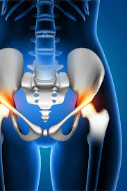 Maybe you would like to learn more about one of these? Penyebab Dan Faktor Resiko Patah Tulang Pinggul Penyakit Yang Umum Dialami Wanita Lansia Golansia Berita Kesehatan Lansia Manula Lanjut Usia