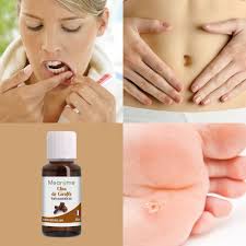 Le clou de girofle est utilisé depuis longtemps pour soulager le mal de dents. Huile Essentielle De Clou De Girofle Bio Ab