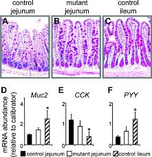 The main function of the ileum is the absorption of digested food. Gata4 Is Essential For The Maintenance Of Jejunal Ileal Identities In The Adult Mouse Small Intestine Molecular And Cellular Biology