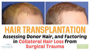 What are the risks and considerations (e.g., shock loss)? Hair Transplant Limitations Ny Hair Loss