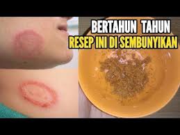 Salah satunya untuk kesembuhan penyakit. Doa Agar Cepat Sembuh Dari Penyakit Gatal Kumpulan Doa Harian Sehari Hari