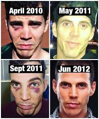 Steve-O