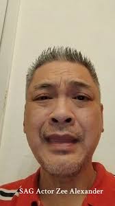 Zee Alexander Freckle Face Boy