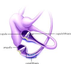 It has been estimated that at least 20% of patients who present to the physician with vertigo have bppv. Diagnosis And Management Of Benign Paroxysmal Positional Vertigo Bppv Cmaj