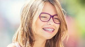 Orthodontist Sugar Land TX Invisalign Braces