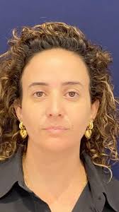 Make a difference 💫🥂🍀 you SHINE girl!! 💖💖💖 #ilovemypatients  #כירורגיתפלסטית #confidencetobe #free2beme