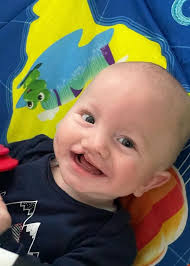 The Story Behind Hunter's Smile