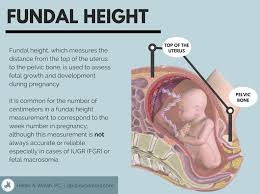 Fetal Growth Restriction Lawyers Hie Cerebral Palsy