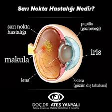 Yellow Dot Sari Nokta Doc Dr Ates Yanyali Nokta