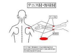 テニス肘 野球肘 health odai chart