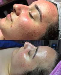 Photo by Angela Halford