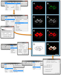 Myasthenia gravis and associated diseases. The Neuromuscular Junction Measuring Synapse Size Fragmentation And Changes In Synaptic Protein Density Using Confocal Fluorescence Microscopy Protocol Translated To Arabic