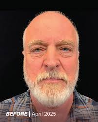 A room packed with education, expertise, and a whole lot of passion! 🧠  Today, our injector team is leveling up at an advanced training in El  Dorado Hills, refining techniques, learning the