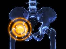 There are many potential causes of a lump in this area. What Your Hip Pain May Be Telling You Health Enews