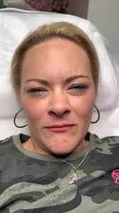 🤍 𝗕𝗥𝗜𝗟𝗟𝗜𝗔𝗡𝗧 𝗥𝗘𝗦𝗨𝗟𝗧𝗦 🤍, Look at my client's results two  weeks after her treatment for her review. Unbelievable results!, Using  wrinkle treatments, I have significantly reduced the appearance of deep ...