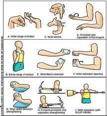 Tennis elbow complications & precautions. Lateral Epicondylitis Physiopedia