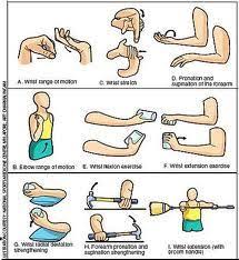 Tennis elbow (lateral epicondylitis) is a common condition that occurs when the outer tendons of the exercise basics. Lateral Epicondylitis Physiopedia