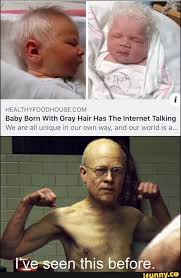 Baby Born With Gray Hair Has The Internet Talking We Are All Unique In Our Own Way And Our World Is A Iª Le Seen This Before