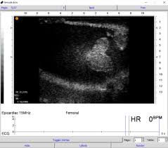 Whether you are a practitioner or a patient, you can now quickly and easily convert and view your 2d radiological scans in 3d. 6 Best Free Open Source Dicom Viewer Software For Windows
