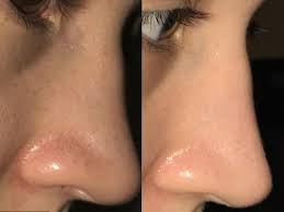Clean it zero purity, ampuh membersihkan wajah dan komedo pada kulit sensitif banila co. Beauty Journal Situs Kecantikan Dan Gaya Hidup Andalan Wanita Masa Kini