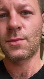 Michael Patock's Instagram, Twitter & Facebook