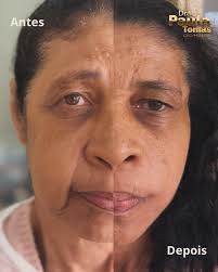 Dra. Paula Tomás- Harmonização Facial (@drapaulatomas) • Instagram photos  and videos