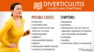 Diverticulitis Causes Symptoms Natural Support Strategies Diverticulitis Diverticulitis Diet Diverticulosis Diet