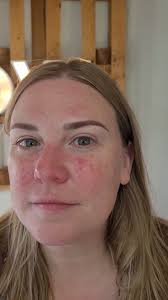 When the skin gets a little "angry" and "juicy" I switch from a whip  shading technique to pointillism, which is well tolerated by sensitive  skin., What makes us different? We don't use permanent ink ...