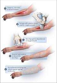 Image result for Skin Tear