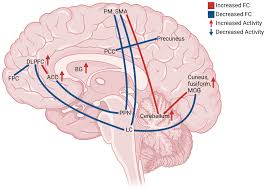 Image result for REM Sleep Behavior Disorder