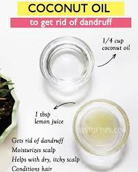 Coconut Oil And Lemon Juice For Dandruff Gets Rid Of Dandruff Moisturizes Scalp Helps Wi Scalp Moisturizer Getting Rid Of Dandruff Dandruff Remedy Coconut Oil