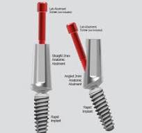 Anatomic Abutments (AA) - Complete Dental Implant Solutions