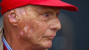 Niki lauda hatte seit seinem schweren unfall auf dem nürburgring 1976 immer wieder gesundheitliche probleme. Interview Mit Niki Lauda 40 Jahre Nach Unfall Auf Nurburgring