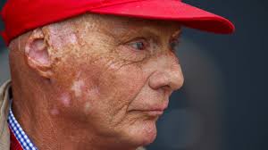 Niki lauda has had a spectacular f1 career but in the nürburgring community he is most famous for his crash on the nordschlife in 1976. Interview Mit Niki Lauda 40 Jahre Nach Unfall Auf Nurburgring