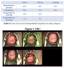 Image result for Colposcopy Findings