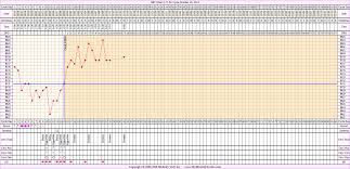 Bbt Chart For Oct 15 2017