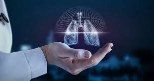 Interstitial Lung Disease Exacerbates Rheumatoid Arthritis Activity Related Conditions