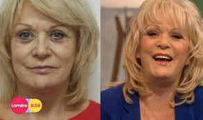 Sherrie hewson has revealed she 'can't stop crying' after her brother's sudden death from brain cancer. Sherrie Hewson In Tears Over Plastic Surgey Makeover On Lorraine Tv Radio Showbiz Tv Express Co Uk