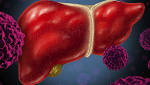  Combining ultrasound imaging with blood test improves cancer detection by 40%: Study