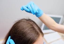 Image result for Hair Pull Test