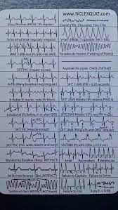 Ekg Heart Rhythms Cheat Sheet Nurse Nursing School Survival Icu Nursing