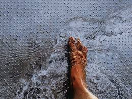 Image result for Pitting nails feet